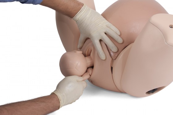 PROMPT Flex - posteriorní porod ruky 2